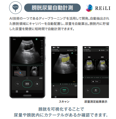 iViz air Ver.3.1 (アセスメントパック特別価格) FUJIFILM