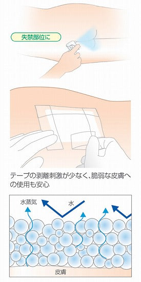 リモイスコート 17711 30mL アルケア 介護用品