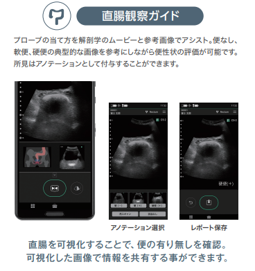 iViz air Ver.3.1 (アセスメントパック特別価格) FUJIFILM