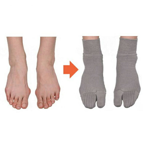 介護 衣類 靴下 外反母趾対策靴下 MKBT コーポレーションパールスター 介護 靴下 ソックス 介護用品