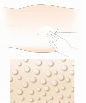 リモイスバリア ハンディ 18033　4g×20パック アルケア (介護 スキンケア おむつかぶれ 皮膚を保護 保湿成分配合) 介護用品