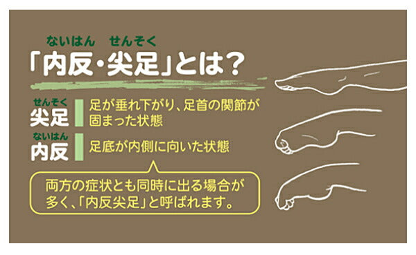 介護シューズ あゆみ レディース メンズ おしゃれ 徳武産業 内反フィット 想 2706 片足販売 (介護 用 スリッパ 室内履き 男女兼用 あゆみシリーズ マジックテープ) 介護用品 父の日 母の日 敬老の日 プレゼント